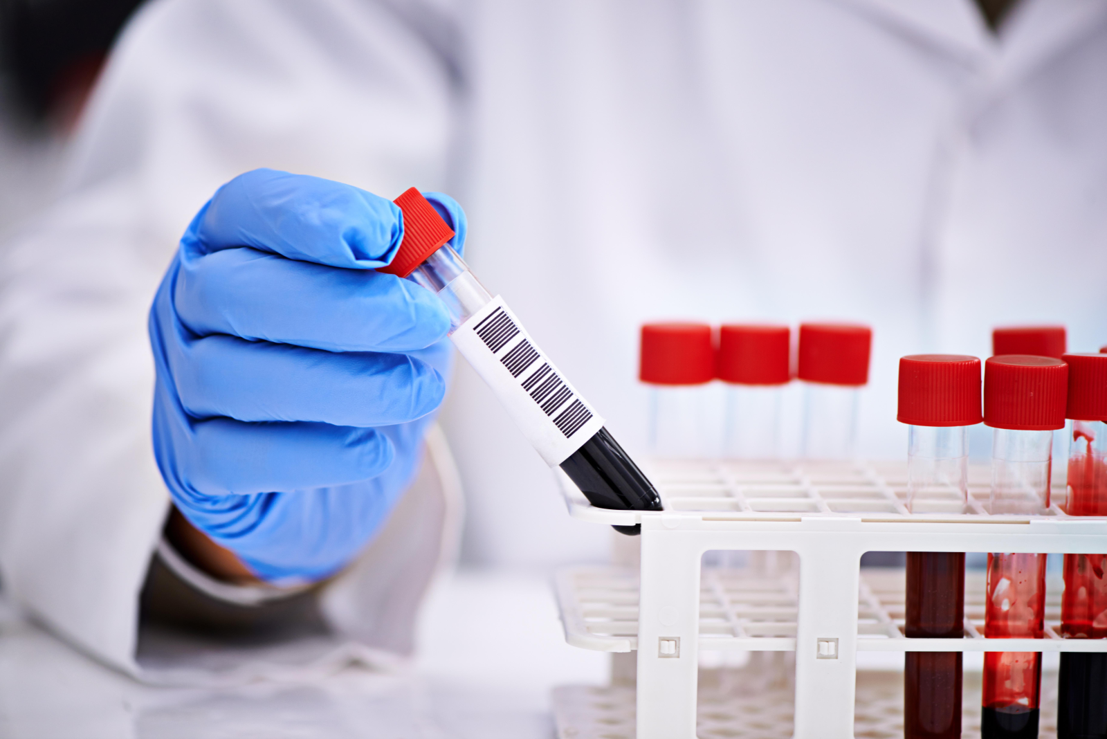 Раннее выявление онкозаболеваний выросло до 35% в Казахстане